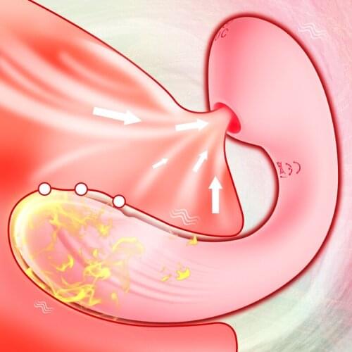 G-Spot Vibrator Sex Suck Invisible Wear for Vagina Clitoris Nipple Sucking Female Masturbation Adult Sex Toys