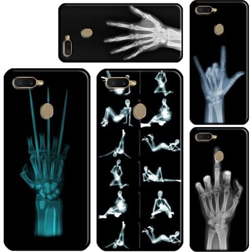 X-ray Hand Bones For OPPO A5S A3S A83 A1K A52 A72 A31 A53 A9 A5 2020 Find X3 Pro F5 F7 A15 A91 Case Cover