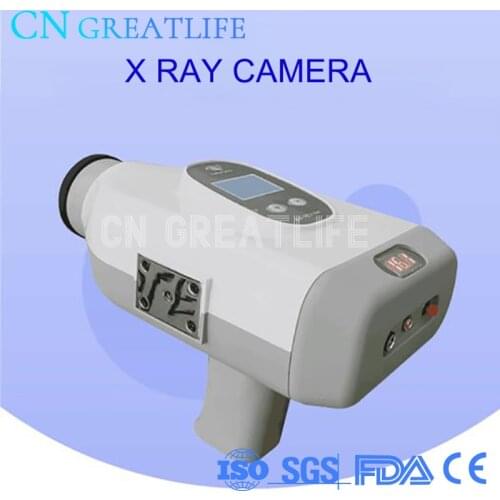 Dental High Frequency X-Ray Unit Digital Portable Dental X Ray Image Unit Machine System Equipment Mobile X Ray Camera