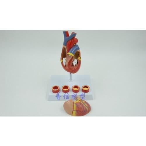 Free shipping&Luxury heart model,Cardiac anatomy model with the 4 stage of cardiovascular, School medical teaching