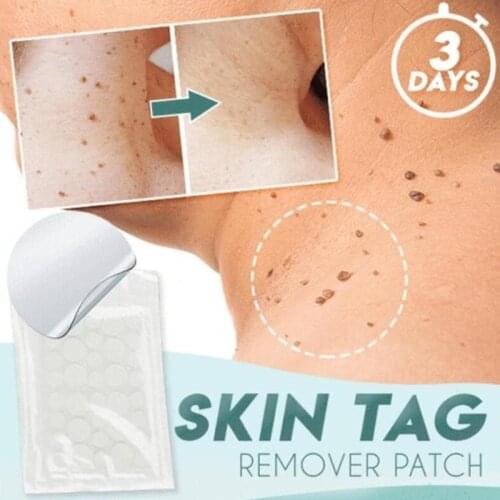 Hot Sale Skin Tag Remover Patch Ance Pimple Wart Plaster Patches Hydrocolloid Master Anti-infection Quick Absorb Face Care Cream