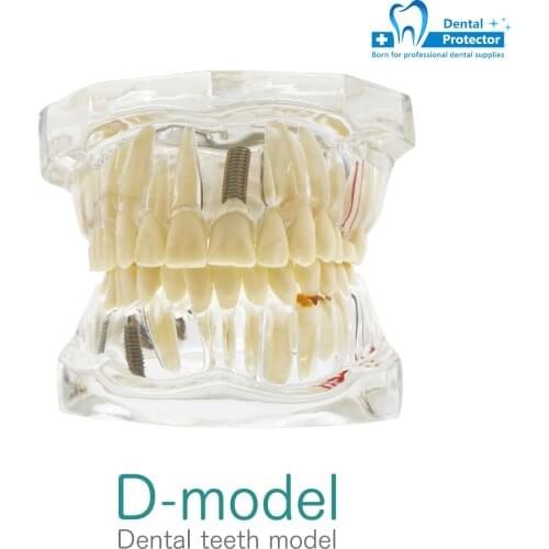 PROTECTOR Dental Materials