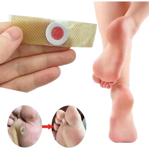 12Pcs Foot Care Medical Plaster Sticker Corn Patches Removal Calluses Plantar Warts Thorn Plaster Health Care For Relieving Pain
