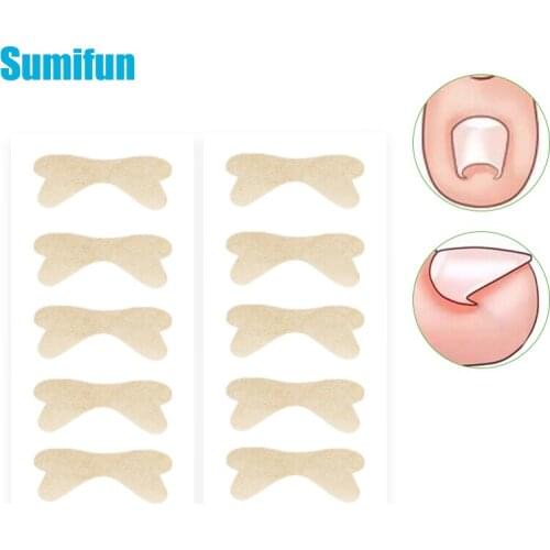 10Pcs Toenail Corrector Toes Ingrown Nails Repair Stickers Nail Groove Curly Armor Correct Inflammatory Ingrown Toe Nail Care