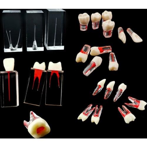 Dental Root Canal Model/Root Pulp Cavity Model Dental Teaching Model