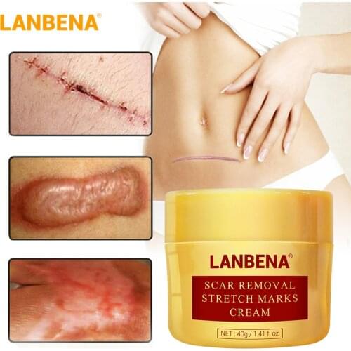 LANBENA Scar Removal Cream Acne Treatment Repairing Scar Blackhead Shrink Pores Whitening Moisturizing Skin Care creme 40g