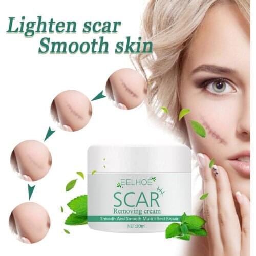 EELHOE Plant Scar Repair Cream Acne Scar Stretch Mark Remover For Burn Scars Old Postoperative Removal Skin Smoothing 30g TSLM1