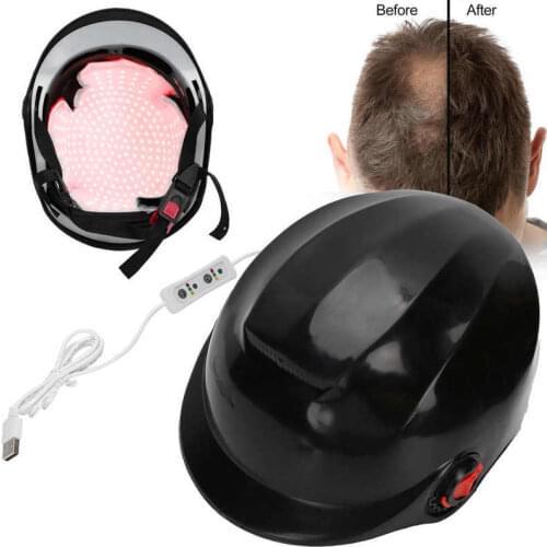 280pcs Diodes Laser Hair Growth Hat Hair Loss Treatment Hair Regrowth Promoter Regrow Laser Helmet Fast Treatment Cap