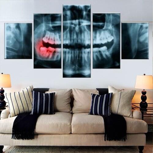 Panoramic Dental X Ray 5 Pieces Modern Canvas Painting Oil Print Poster HD Picture For Living Room Office Home Decoration