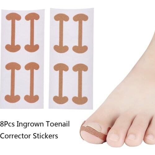 2Sheets Ingrown Toe Nail Correction Sticker Patch Paronychia Corrector File Elastic Patch Corrector Foot Care Treatment Pedicure