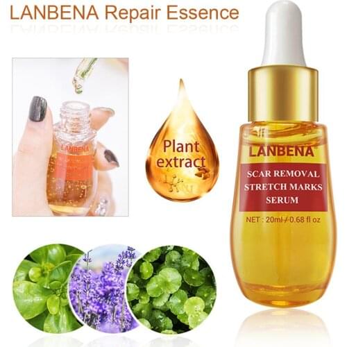 LANBENA Acne Essence Care Remove Acne Marks Stretch Mark Moisturizing Shrinkage Pore Blackhead Repair Essence Skin Care