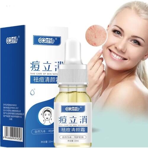 Effective Acne Removal Serum Acne Treatment Fade Acne Spots Oil Control Shrink Pores Moisturizing Acne Essence Skin Care