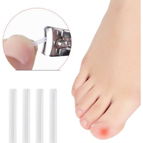 10Pcs/Set Ingrown Pads Nail Groove Orthopedic Pads Nail Correction Devices Correction Treatments Sticker Patch Foot Care Tools