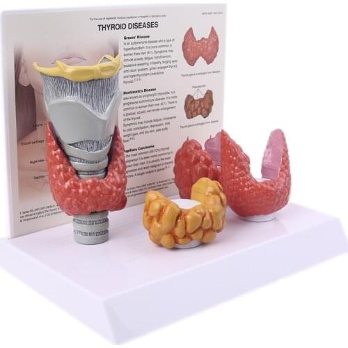 Human Anatomical Thyroid Gland Model Pathology Anatomy Digestive System Display Study Teaching Tool Halloween