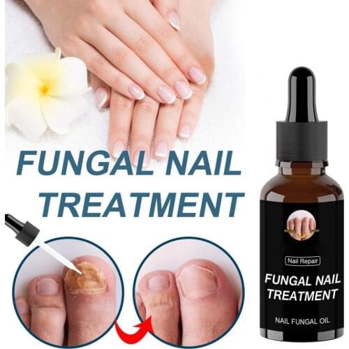 10ml/20ml/30ml/50ml Nail Fungal Oil Anti Infection Moisturizing Synthetic Gentle Nail Repair Essence for Onychomycosis Repair