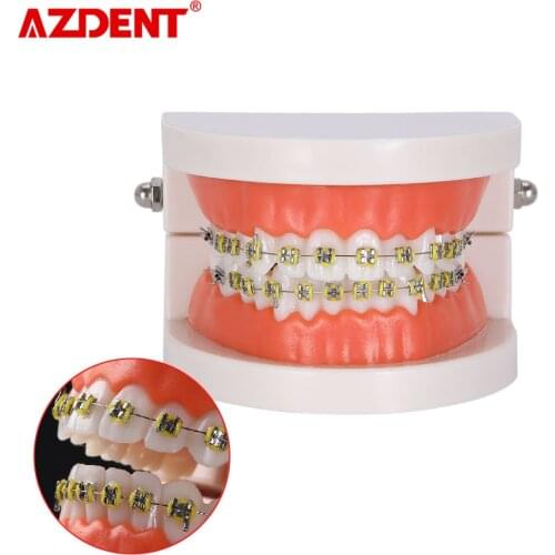 Dental Orthodontic model Orthodontic model Dental Bracket Teeth model
