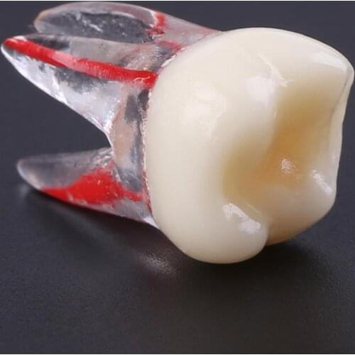 1pc 1:1 Resin Dental Endodontic Tooth Model With Colored Root Canal and Pulp Model Dentist Tools for Student Study Practice