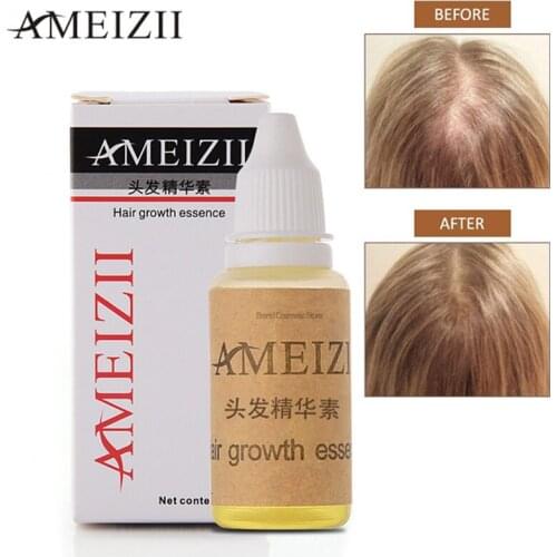 12 PCS AMEIZII YIGANERJING 20ml Ginger Extract Sunburst Hair Growth Essence Restoration Hair Loss Liquid Serum Hair Care Oil
