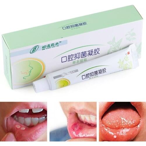 ORAL ULCER SOOTHING GEL, natural herbal antibacterial cream for oral hygiene, severe pain irritation, halitosis