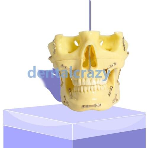 1pc dentist practice tools Dental model 2016 Anchor Implant Screw Practice Model