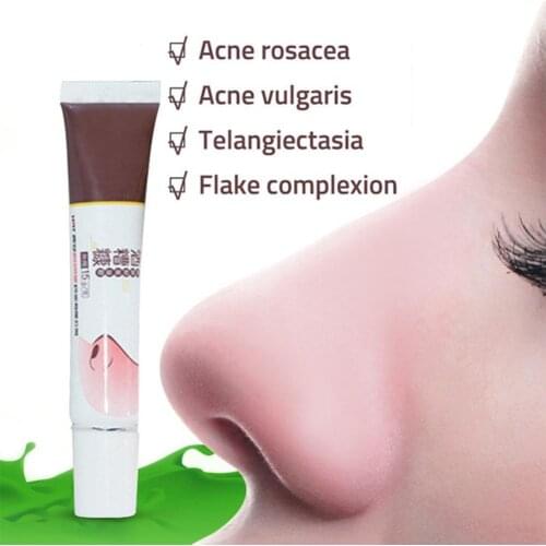 Herbal Anti Nose Mites Remove Acne Rosacea Cream Red Nose Blackhead Remover Acne Treatment Shrink Pores Face Bleaching Ointment