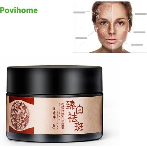 30G Whitening Freckle Cream Chinese Herbal Plant Face Cream Remove Freckles and Dark Spots Skin Whitening Cream P1178