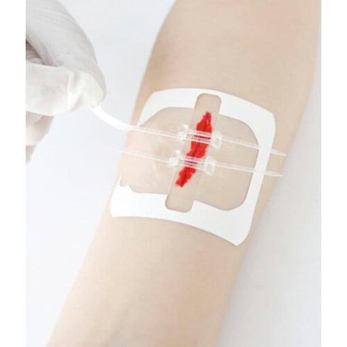 Zipp Band-Aid Painless Suture Adhesive Wound Closure Wound Aid Patch Fast Hemostatic Care Health Band Suture Accessories