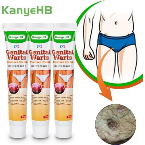 3pcs Private Part Wart Removal Cream Genital Warts Special Ointment Penis Vulva Herpes Condyloma Acuminatum Herbal Ointment A659