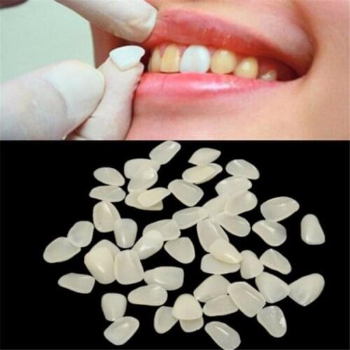70pcs/pack New Fashion Teeth Care Tools Dental Temporary Crown Ultra Thin Resin Whitening Teeth Anterior Shade Tooth Veneers