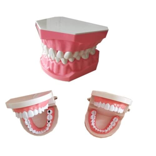 Dental Implant Teeth Model Teaching Study Model Dentist Resin Tooth Orthodontic Modeling For Student Practice