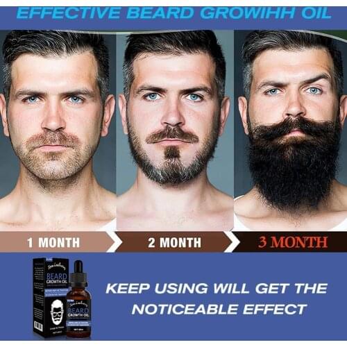 Thicker Beard Oil Spray Organic Hair Growth Oil Enhancer Re-growth Product Extension Hair Fuller Hair Essence 30ml Loss Den G8P1