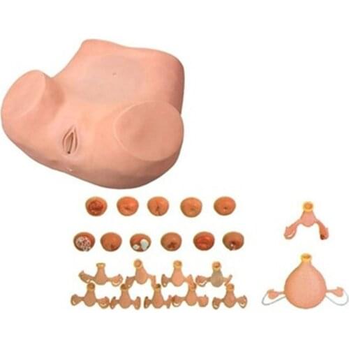 Advanced Gynecological Examination Model,Vaginal and Pelvic Examination Model