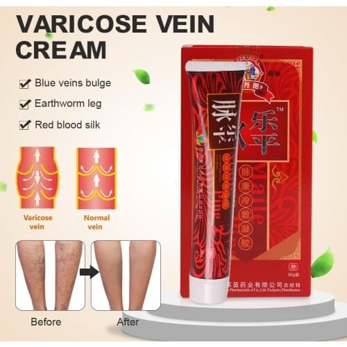 30g Veins Pain Relief Medical Ointment Varicose Veins Treatment Cream Vasculitis Phlebitis Spider Vascular Nerve Improve Plaster