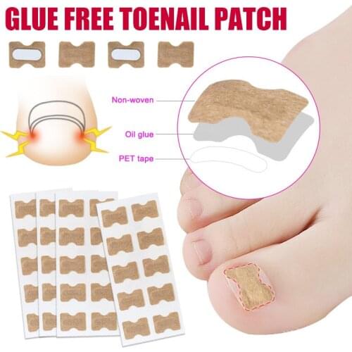 Foot Care Stickers Toenail Correction Sticker Glue-free for Men Women Professional Pedicure Toenail Care Tool SANA889