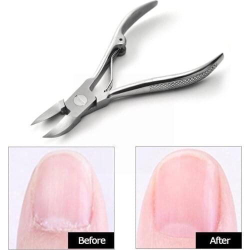 Pro Nail Scissors Special Nail Scissors Oblique Mouth Dead Skin Tool Nail Olecranon Nipper Trimmer Toenails Groove R2U7 S8B5