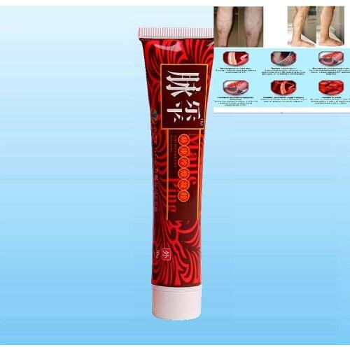 Removal Herbal Cream Varicose Veins Treatment Cream Ointment Vasculitis Phlebitis Spider Veins Pain Varicosity Angiitis Remedy