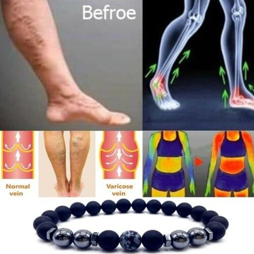 Health Care Weight Loss Magnetic Therapy Element Bracelet Arthritis Pain Relief Health Energy Biological Varicose Vein Treatment