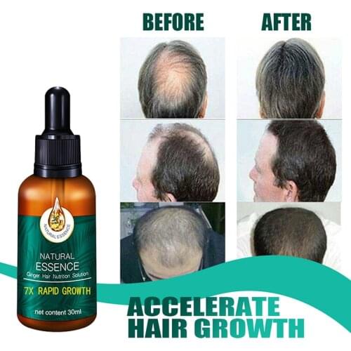 Hair regrow Hair Growth Essence Hair Repair Treatment Liquid Regrowth Essential Oil Serum Preventing Hair Loss Fast Restoratio