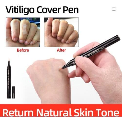 Vitiligo Scars Birthmarks Cover Pen Professional White Spots Tattoo Concealer Herbal Plant Essence Skin Cover Pen Women And Men