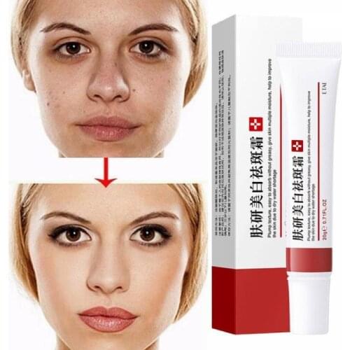 Effective Freckle Cream Remove Dark Spots Witening Cream Fade Acne Scars Melanin Pigmentation Melasma Anti-Aging Skin Lightening