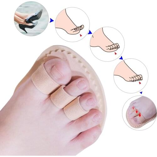 1Pcs Toe Correction Pad Forefoot Pads Finger Toes Separator Straightener Hallux Valgus Orthotics Orthopedic Overlap C171