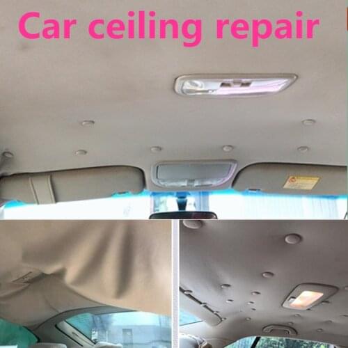 10pcs Car styling new sale Repair parts Button for Audi A3 8V A4 B5 B6 B7 B8 A6 C5 A5 TT Q3 Q5 Q7 80 100 A1 A2 A7 A8 S3 S4 R8