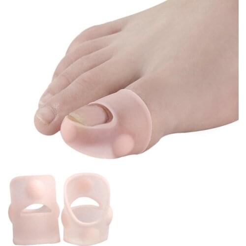 Ingrown Toenail Nail Groove Nail Correction Ingrown Toe Prevent Nails From Growing In The Flesh Paronychia Treatment