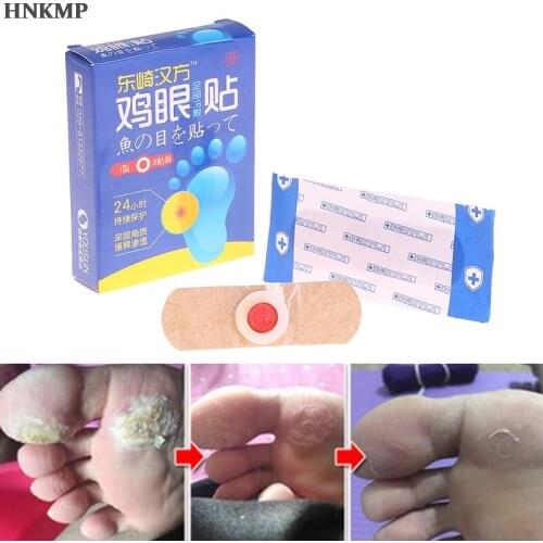 Exfoliating Corn Foot Patch Soft Feet Problem Remove Hard Dead Skin Treatment Removed Foot Plantar warts Calluses Away 8 pcs/box