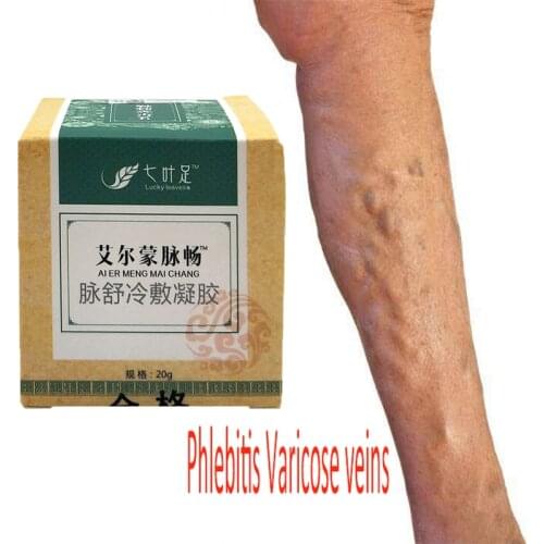 Varicose Veins Cream of Varicose Veins Medical Spider Veins Treatment Chinese Herbal Medicine Varicose Veins Ointment 20g