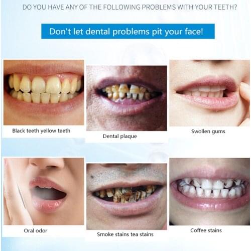 Teeth whitening grams remove smoke stains coffee stains tea stains fresh breath bad breath oral hygiene dental care