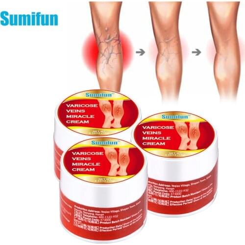 10g Varicose Veins Ointment Vasculitis Phlebitis Spider Leg Treatment Cream Varicosity Angiitis Removal Herbal Medical Plaster