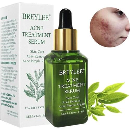 17ml Acne Treatment Serum Face Facial Essence Anti Acne Scar Removal Cream Skin Care Whitening Repair Pimple Remover Acne