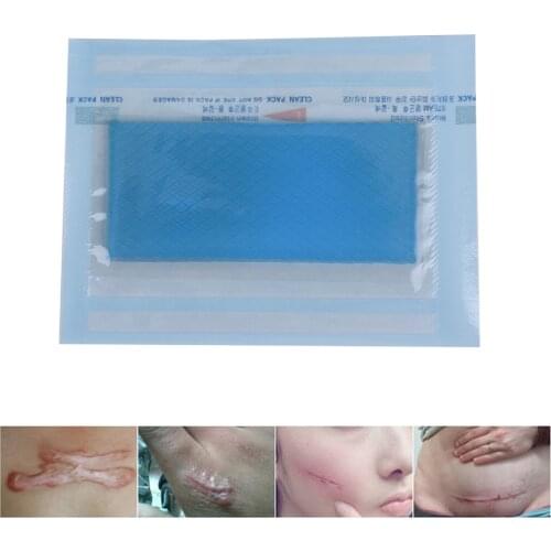 3.5*7cm Removal Cesarean Section Hypertrophic Keloid Skin Scars Therapy Treatment Scar Away Patch Silicone Gel Sheet Wound Marks