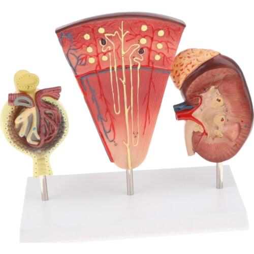 Magnified Human Kidney Nephron Glomeruli Structure Anatomical Model Display Lab/Medical Study Kits
